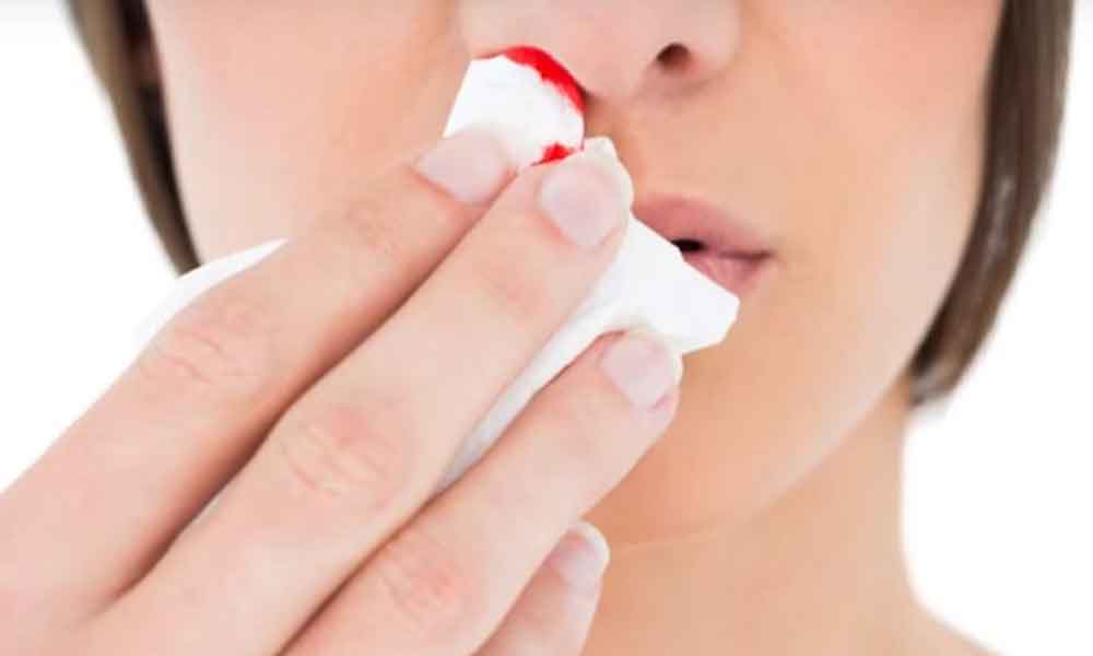गर्मी में नाक से खून निकलने के कारण व् उपाय