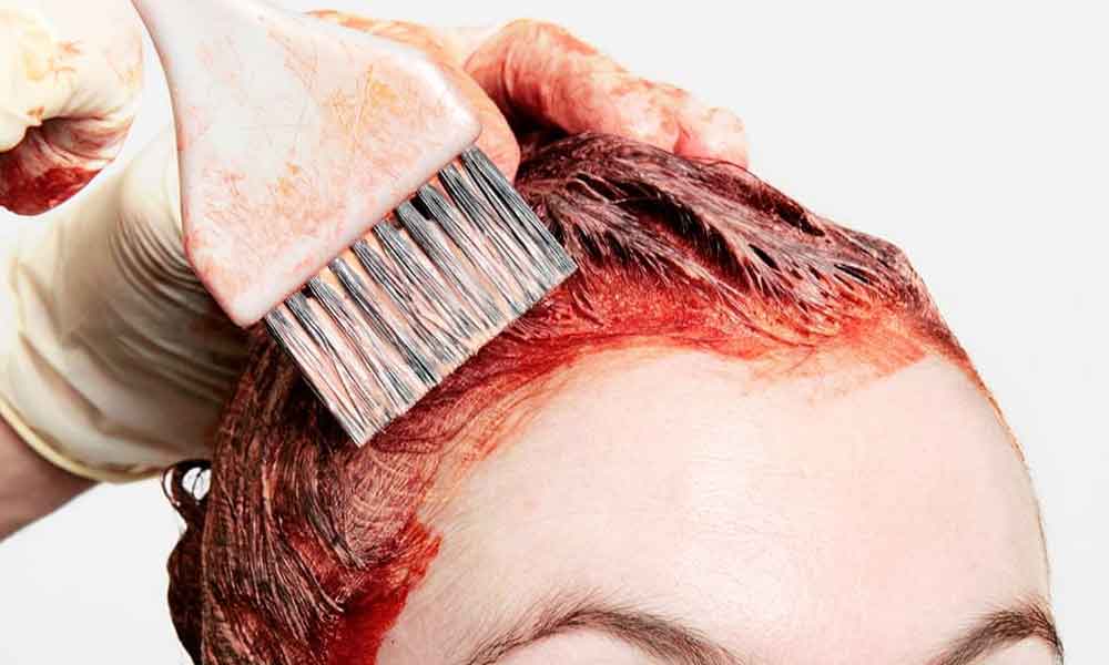 Easiest ways to remove hair dye stain from your face skin 