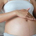 Tips to avoid stretchmarks during pregnancy