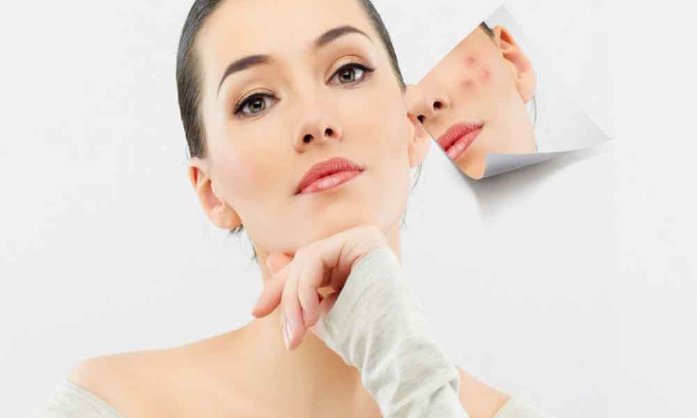 Tips to remove black spots from face