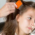 Remedies for lice