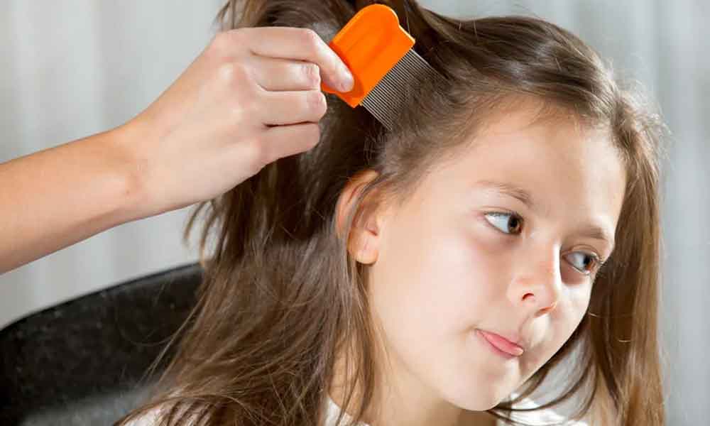 Remedies for lice
