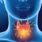 Thyroid Remedies